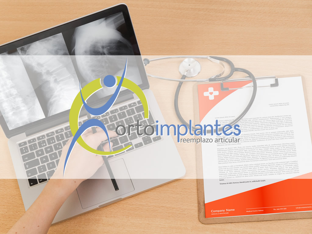 Ortoimplantes